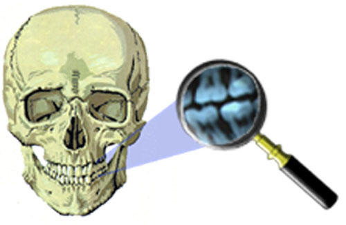 Dental Identification